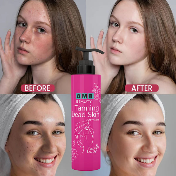 AMR - Ultimate Tanning Dead Skin Remover (Buy 1 Get 1)