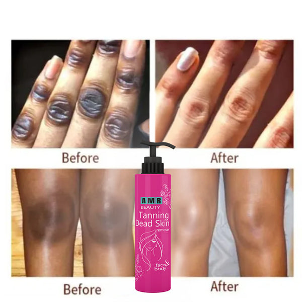 AMR - Ultimate Tanning Dead Skin Remover (Buy 1 Get 1)